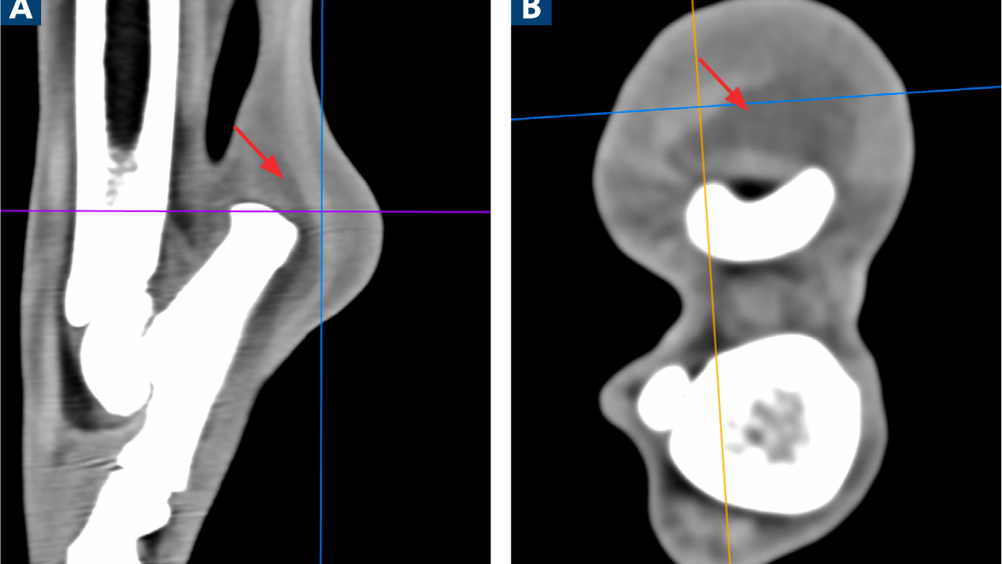 UK Vet Companion Animal - Surgical treatment of a bilateral superficial ...